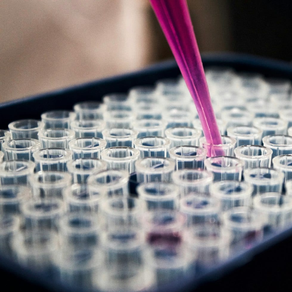 Researcher pipetting samples into a multi-well plate